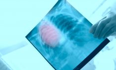 X-ray in the hands of a surgeon