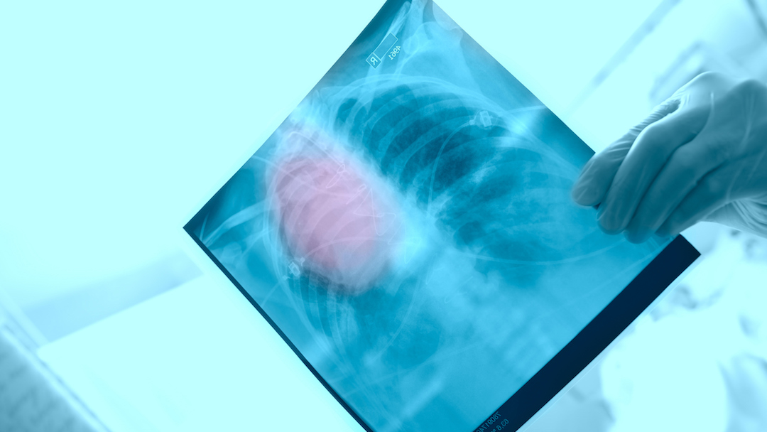 X-ray in the hands of a surgeon