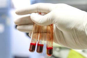 Medical equipment. Blood test